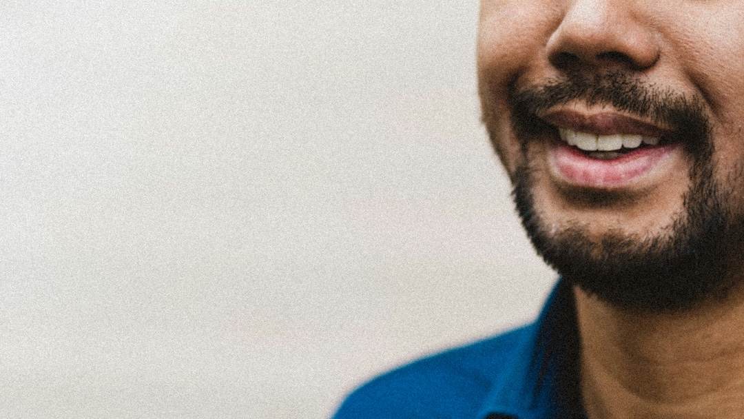 All-on-4 dental implants Hattiesburg Mississippi