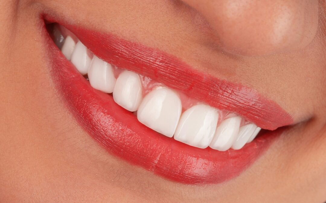 Dental Implants in Hattiesburg, MS: Cost, Process, and What Self-Paid Patients Should Know